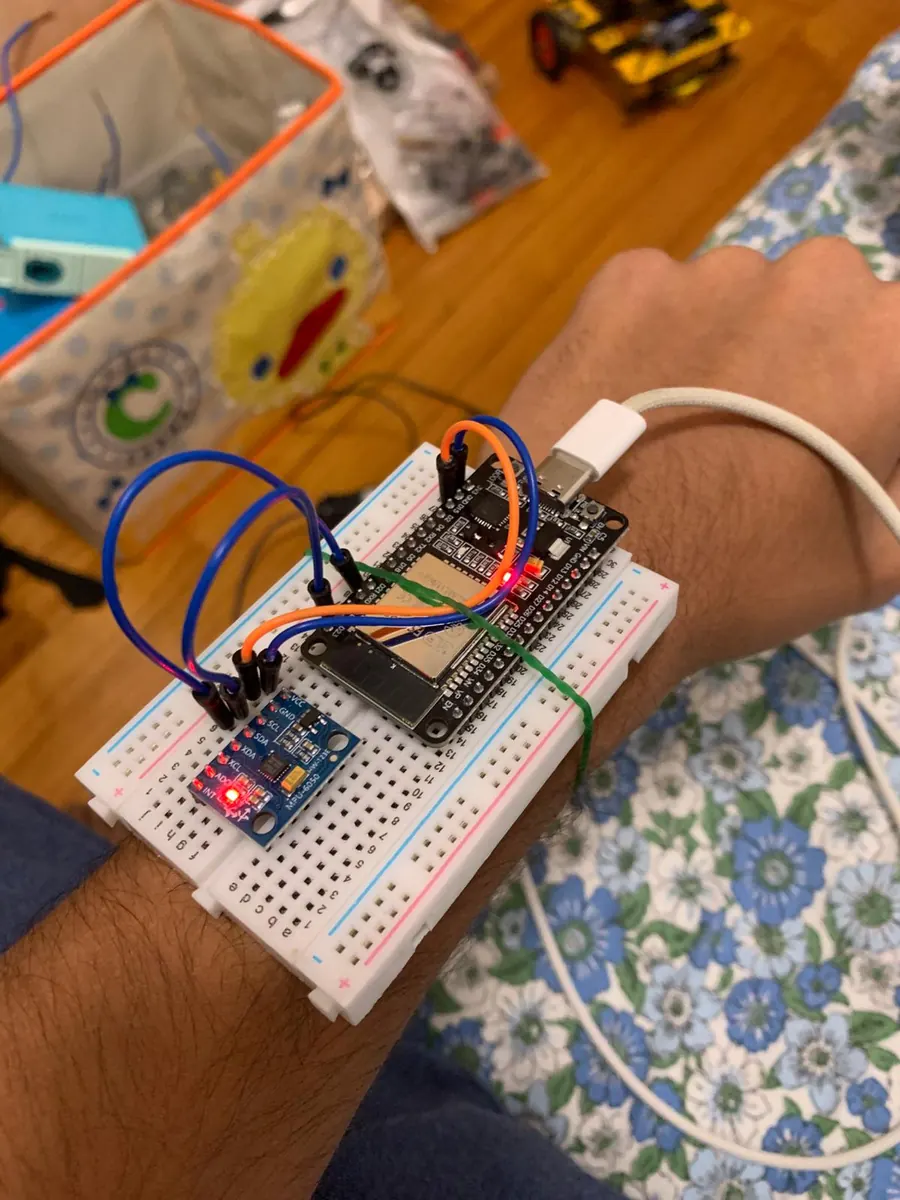 Early LYRA prototype worn on the wrist — an ESP32 board and MPU-6050 IMU wired on a breadboard